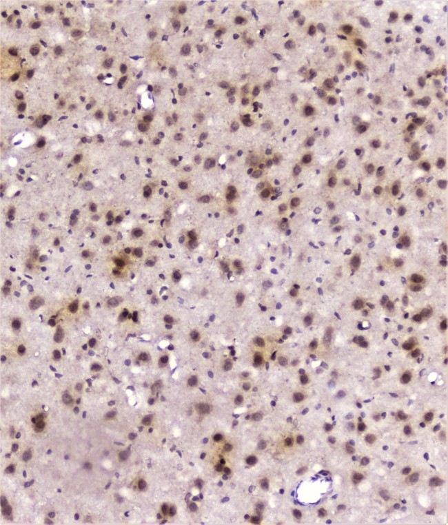 DDT / Dopamine Tautomerase Antibody - IHC analysis of DDT using anti-DDT antibody. DDT was detected in paraffin-embedded section of rat brain tissue. Heat mediated antigen retrieval was performed in citrate buffer (pH6, epitope retrieval solution) for 20 mins. The tissue section was blocked with 10% goat serum. The tissue section was then incubated with 2µg/ml rabbit anti-DDT Antibody overnight at 4°C. Biotinylated goat anti-rabbit IgG was used as secondary antibody and incubated for 30 minutes at 37°C. The tissue section was developed using Strepavidin-Biotin-Complex (SABC) with DAB as the chromogen.