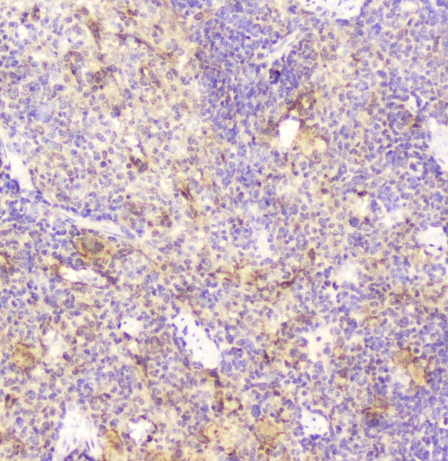 DDT / Dopamine Tautomerase Antibody - IHC analysis of DDT using anti-DDT antibody. DDT was detected in paraffin-embedded section of rat spleen tissue. Heat mediated antigen retrieval was performed in citrate buffer (pH6, epitope retrieval solution) for 20 mins. The tissue section was blocked with 10% goat serum. The tissue section was then incubated with 2µg/ml rabbit anti-DDT Antibody overnight at 4°C. Biotinylated goat anti-rabbit IgG was used as secondary antibody and incubated for 30 minutes at 37°C. The tissue section was developed using Strepavidin-Biotin-Complex (SABC) with DAB as the chromogen.