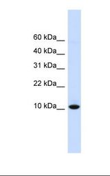 DDT / Dopamine Tautomerase Antibody - Fetal liver lysate. Antibody concentration: 1.0 ug/ml. Gel concentration: 10-20%.  This image was taken for the unconjugated form of this product. Other forms have not been tested.