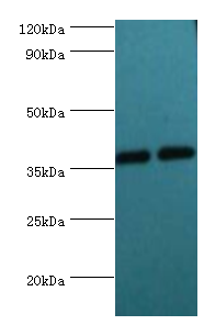 DDX / AKR1C3 Antibody - Western blot. All lanes: Aldo-keto reductase family 1 member C3 antibody at 8 ug/ml. Lane 1: K562 whole cell lysate. Lane 2: 293T whole cell lysate. Secondary antibody: Goat polyclonal to rabbit at 1:10000 dilution. Predicted band size: 37 kDa. Observed band size: 37 kDa.