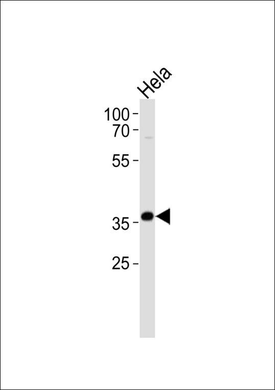 DDX / AKR1C3 Antibody - AKR1C3 Antibody western blot of HeLa cell line lysates (35 ug/lane). The AKR1C3 antibody detected the AKR1C3 protein (arrow).
