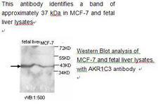 DDX / AKR1C3 Antibody