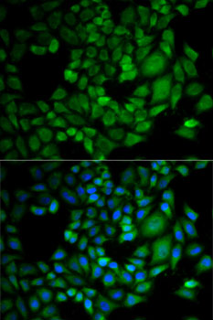DDX / AKR1C3 Antibody - Immunofluorescence analysis of HeLa cells using AKR1C3 antibody. Blue: DAPI for nuclear staining.