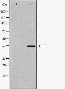 DDX / AKR1C3 Antibody - Western blot analysis of extracts of Jurkat cells using AKR1C3 antibody. The lane on the left is treated with the antigen-specific peptide.