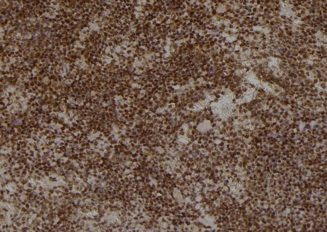 DDX / AKR1C3 Antibody - 1:100 staining mouse spleen tissue by IHC-P. The sample was formaldehyde fixed and a heat mediated antigen retrieval step in citrate buffer was performed. The sample was then blocked and incubated with the antibody for 1.5 hours at 22°C. An HRP conjugated goat anti-rabbit antibody was used as the secondary.