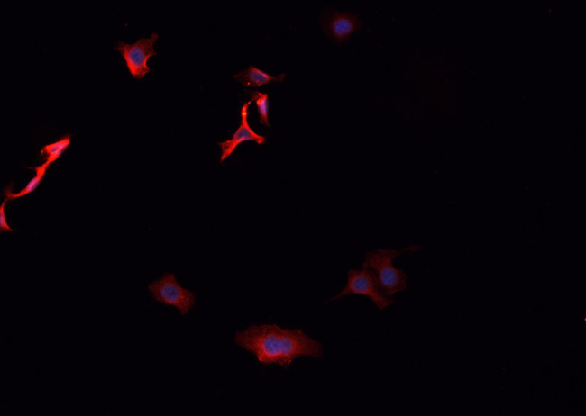 DDX / AKR1C3 Antibody - Staining HeLa cells by IF/ICC. The samples were fixed with PFA and permeabilized in 0.1% Triton X-100, then blocked in 10% serum for 45 min at 25°C. The primary antibody was diluted at 1:200 and incubated with the sample for 1 hour at 37°C. An Alexa Fluor 594 conjugated goat anti-rabbit IgG (H+L) antibody, diluted at 1/600, was used as secondary antibody.