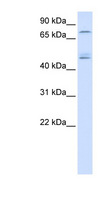 DDX1 Antibody - DDX1 antibody Western blot of Fetal Muscle lysate. This image was taken for the unconjugated form of this product. Other forms have not been tested.