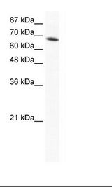 DDX1 Antibody - Jurkat Cell Lysate.  This image was taken for the unconjugated form of this product. Other forms have not been tested.