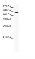 DDX1 Antibody - Jurkat Cell Lysate.  This image was taken for the unconjugated form of this product. Other forms have not been tested.