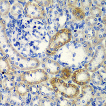 DDX1 Antibody - Immunohistochemistry of paraffin-embedded rat kidney tissue.