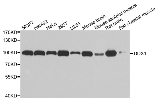 DDX1 Antibody - Western blot analysis of extracts of various cell lines.