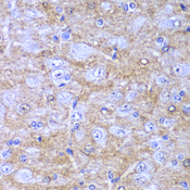 DDX1 Antibody - Immunohistochemistry of paraffin-embedded rat brain tissue.