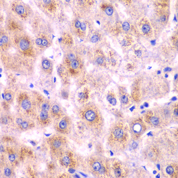 DDX1 Antibody - Immunohistochemistry of paraffin-embedded human liver injury tissue.