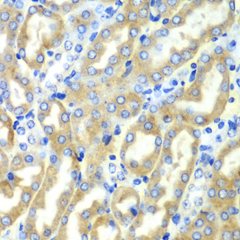 DDX1 Antibody - Immunohistochemistry of paraffin-embedded mouse kidney tissue.
