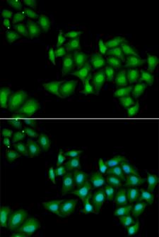 DDX1 Antibody - Immunofluorescence analysis of HeLa cells.