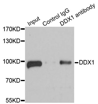 DDX1 Antibody - Immunoprecipitation analysis of 100ug extracts of 293T cells.