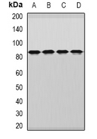 DDX1 Antibody - Western blot analysis of DDX1 expression in MCF7 (A); HepG2 (B); mouse brain (C); rat brain (D) whole cell lysates.