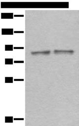 DDX1 Antibody - Western blot analysis of Mouse brain tissue and Rat brain tissue lysates  using DDX1 Polyclonal Antibody at dilution of 1:300