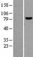 DDX1 Protein - Western validation with an anti-DDK antibody * L: Control HEK293 lysate R: Over-expression lysate