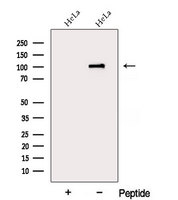 DDX10 Antibody - Western blot analysis of extracts of HeLa cells using DDX10 antibody. The lane on the left was treated with blocking peptide.