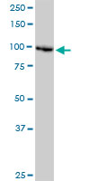 DDX11 / CHLR1 Antibody - DDX11 monoclonal antibody (M03), clone 3C1. Western blot of DDX11 expression in HeLa.