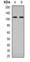 DDX11 / CHLR1 Antibody - Western blot analysis of DDX11 expression in HT29 (A); MCF7 (B) whole cell lysates.