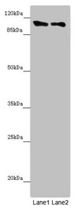 DDX11 / CHLR1 Antibody - Western blot All Lanes: DDX11 antibody at 8.47 ug/ml Lane 1: Mouse gonadal tissue Lane 2: K562 whole cell lysate Secondary Goat polyclonal to rabbit IgG at 1/10000 dilution Predicted band size: 109,102,99,97,33 kDa Observed band size: 108 kDa