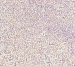 DDX11 / CHLR1 Antibody - Immunohistochemistry of paraffin-embedded human tonsil tissue at dilution 1:100