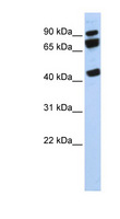 DDX17 Antibody - DDX17 antibody Western blot of 721_B cell lysate. This image was taken for the unconjugated form of this product. Other forms have not been tested.