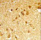 DDX17 Antibody - Formalin-fixed and paraffin-embedded human brain tissue reacted with DDX17 Antibody , which was peroxidase-conjugated to the secondary antibody, followed by DAB staining. This data demonstrates the use of this antibody for immunohistochemistry; clinical relevance has not been evaluated.