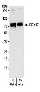 DDX17 Antibody - Detection of Human DDX17 by Western Blot. Samples: Whole cell lysate (15 and 50 ug) from HeLa cells. Antibodies: Affinity purified rabbit anti-DDX17 antibody used for WB at 1 ug/ml. Detection: Chemiluminescence with an exposure time of 1 second.