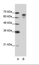 DDX17 Antibody - A: Marker, B: Jurkat Cell Lysate.  This image was taken for the unconjugated form of this product. Other forms have not been tested.