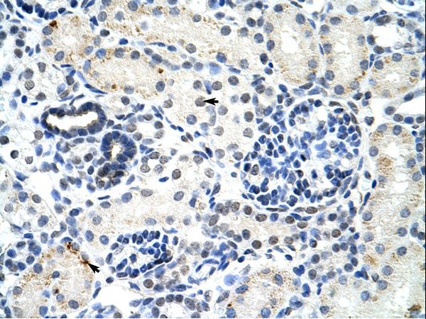DDX17 Antibody - DDX17 antibody ARP41029_T100-EAW60248-DDX17 (DEAD (Asp-Glu-Ala-Asp) box polypeptide 17) Antibody was used in IHC to stain formalin-fixed, paraffin-embedded human kidney.  This image was taken for the unconjugated form of this product. Other forms have not been tested.
