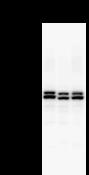 DDX17 Antibody - Detection of DDX17 by Western blot. Samples: Whole cell lysate from human HEK293 (H, 25 ug) , mouse NIH3T3 (M, 25 ug) and rat F2408 (R, 25 ug) cells. Predicted molecular weight: 80 kDa