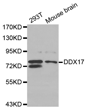 DDX17 Antibody - Western blot analysis of extracts of various cell lines.