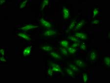 DDX17 Antibody - Immunofluorescence staining of Hela cells at a dilution of 1:100, counter-stained with DAPI. The cells were fixed in 4% formaldehyde, permeabilized using 0.2% Triton X-100 and blocked in 10% normal Goat Serum. The cells were then incubated with the antibody overnight at 4 °C.The secondary antibody was Alexa Fluor 488-congugated AffiniPure Goat Anti-Rabbit IgG (H+L) .