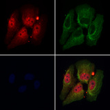 DDX17 Antibody - Staining HeLa cells by IF/ICC. The samples were fixed with PFA and permeabilized in 0.1% Triton X-100, then blocked in 10% serum for 45 min at 25°C. Samples were then incubated with primary Ab(1:200) and mouse anti-beta tubulin Ab(1:200) for 1 hour at 37°C. An AlexaFluor594 conjugated goat anti-rabbit IgG(H+L) Ab(1:200 Red) and an AlexaFluor488 conjugated goat anti-mouse IgG(H+L) Ab(1:600 Green) were used as the secondary antibod