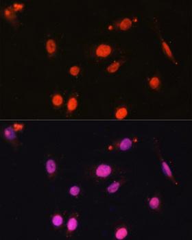 DDX17 Antibody - Immunofluorescence analysis of U2OS cells using DDX17 Polyclonal Antibody at dilution of 1:100.Blue: DAPI for nuclear staining.