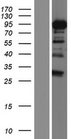 DDX17 Protein - Western validation with an anti-DDK antibody * L: Control HEK293 lysate R: Over-expression lysate