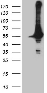 DDX19A Antibody - HEK293T cells were transfected with the pCMV6-ENTRY control. (Left lane) or pCMV6-ENTRY DDX19A. (Right lane) cDNA for 48 hrs and lysed. Equivalent amounts of cell lysates. (5 ug per lane) were separated by SDS-PAGE and immunoblotted with anti-DDX19A. (1:2000)