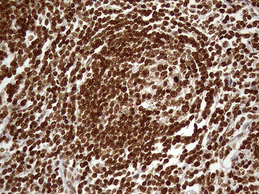 DDX19A Antibody - Immunohistochemical staining of paraffin-embedded Human lymph node tissue within the normal limits using anti-DDX19A mouse monoclonal antibody. (Heat-induced epitope retrieval by 1mM EDTA in 10mM Tris buffer. (pH8.5) at 120°C for 3 min. (1:500)