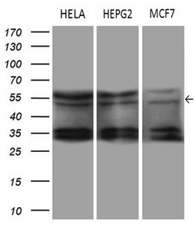 DDX19A Antibody - Western blot analysis of extracts. (35ug) from 3 different cell lines by using anti-DDX19A monoclonal antibody. (1:500)