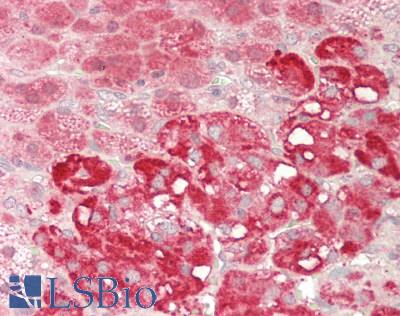 DDX19A Antibody - Human Adrenal: Formalin-Fixed, Paraffin-Embedded (FFPE).  This image was taken for the unconjugated form of this product. Other forms have not been tested.
