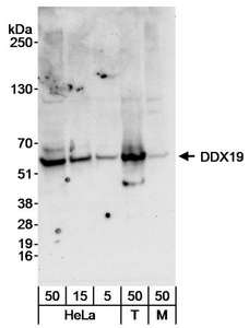 DDX19B Antibody - Detection of Human and Mouse DDX19 by Western Blot. Samples: Whole cell lysate from HeLa (5, 15 and 50 ug), 293T (T; 50 ug) and NIH3T3 (M; 50 ug) cells. Antibody: Affinity purified rabbit anti-DDX19 antibody used at 0.04 ug/ml for WB. Detection: Chemiluminescence with an exposure time of 30 seconds.