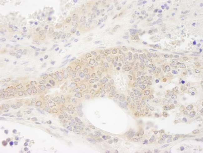 DDX19B Antibody - Detection of Mouse DDX19 by Immunohistochemistry. Sample: FFPE section of mouse teratoma. Antibody: Affinity purified rabbit anti-DDX19 used at a dilution of 1:250. Epitope Retrieval Buffer-High pH (IHC-101J) was substituted for Epitope Retrieval Buffer-Reduced pH.