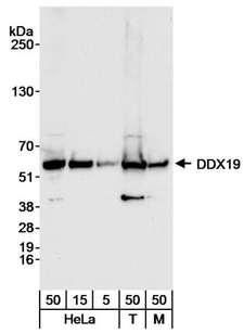 DDX19B Antibody - Detection of Human and Mouse DDX19 by Western Blot. Samples: Whole cell lysate from HeLa (5, 15 and 50 ug), 293T (T; 50 ug) and NIH3T3 (M; 50 ug) cells. Antibody: Affinity purified rabbit anti-DDX19 antibody used at 0.04 ug/ml for WB. Detection: Chemiluminescence with an exposure time of 10 seconds.