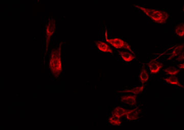 DDX19B Antibody - Staining HT29 cells by IF/ICC. The samples were fixed with PFA and permeabilized in 0.1% Triton X-100, then blocked in 10% serum for 45 min at 25°C. The primary antibody was diluted at 1:200 and incubated with the sample for 1 hour at 37°C. An Alexa Fluor 594 conjugated goat anti-rabbit IgG (H+L) Ab, diluted at 1/600, was used as the secondary antibody.