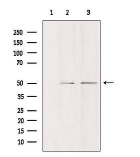 DDX19B Antibody - Western blot analysis of extracts of various samples using DDX19B antibody. Lane 1: HeLa treated with the antigen-specific peptide. Lane 2: HeLa; Lane 3: 293;