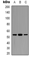 DDX19B Antibody - Western blot analysis of DDX19B expression in HepG2 (A); K562 (B); A549 (C) whole cell lysates.