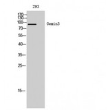 DDX20 / GEMIN3 Antibody - Western blot of Gemin3 antibody